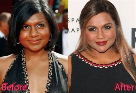 mindy kaling bleaching